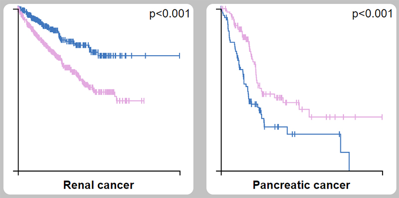 SSTR2 as a prognostic marker in kidney cancer (unfavorable) and pancreatic cancer (favorable)