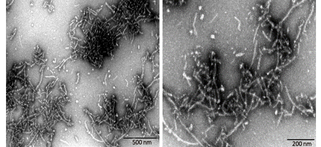 Protein aggregates with distinct fibrous structures are visible with accurate morphology