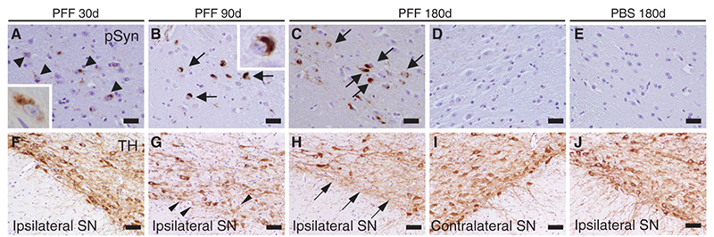 α-Syn immunostaining of substantia nigra pars compacta of mice following intrastriatal PFF injection.
