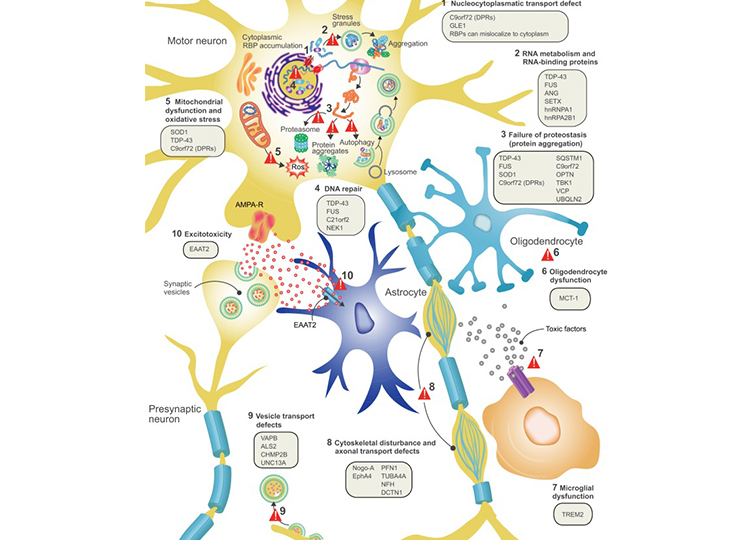 ALS disease pathology and proposed disease mechanisms