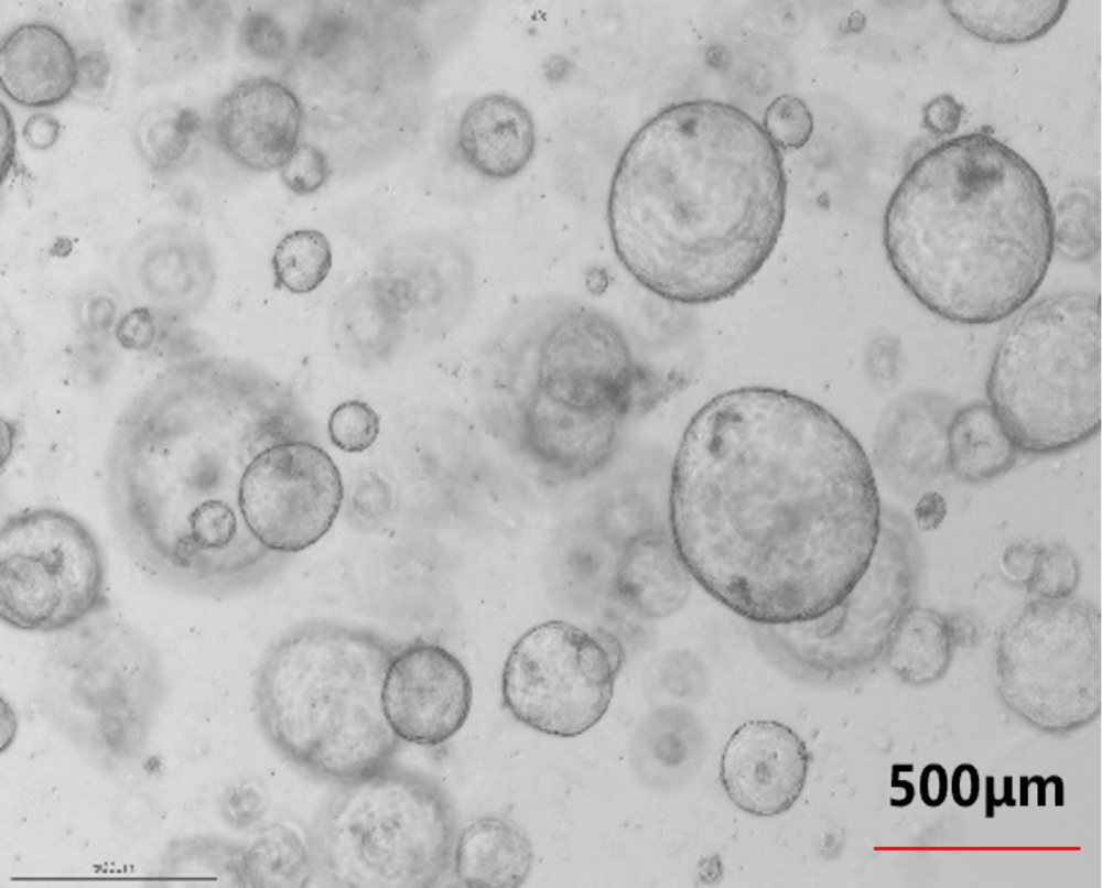 Liver ductal organoid