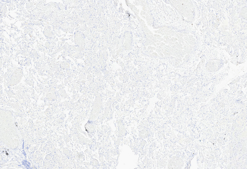 Immunohistochemistry (Formalin/PFA-fixed paraffin-embedded sections) -Recombinant Monoclonal Anti-Claudin-18.2 Antibody, Mouse (3B10) (HCS-S278)Human Lung Tissue, 4X