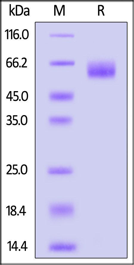 IL-1RL1 SDS-PAGE