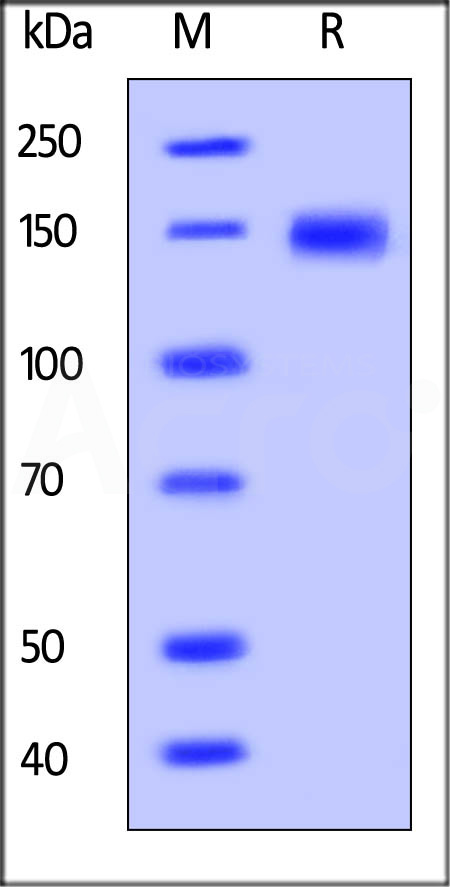 LDL R SDS-PAGE