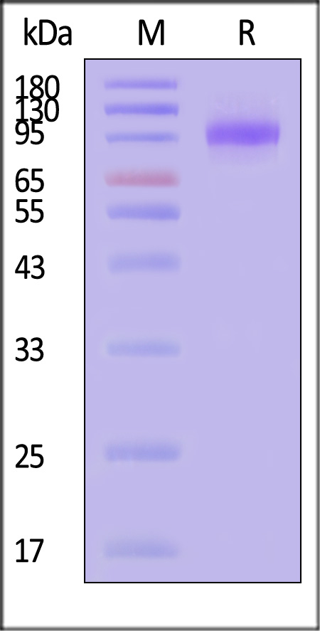 Human LRRC4, His Tag (Cat. No. LR4-H5221) SDS-PAGE gel